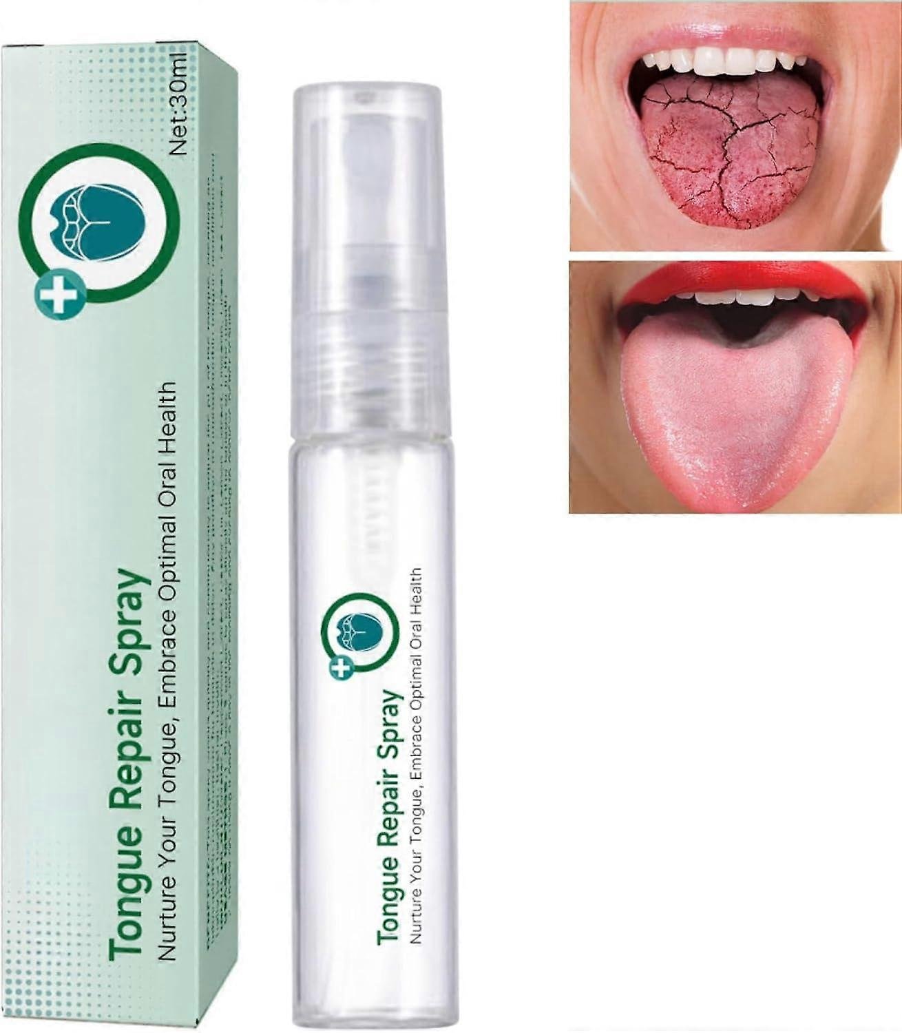 Tongue Repair Spray, Mouth Odor Eliminator for Dryness& Bad Breath,Fissured Tongue Relief Spray, Ins